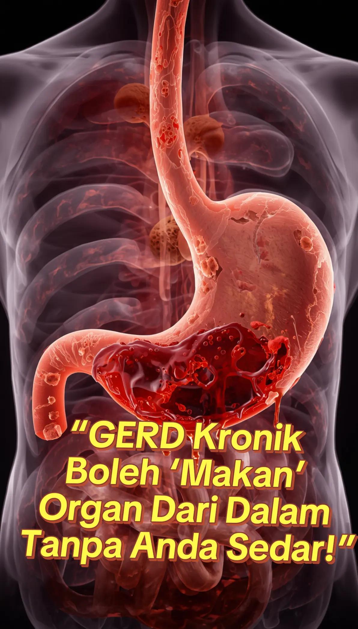 @TERAPI IMUN SEMULAJADI