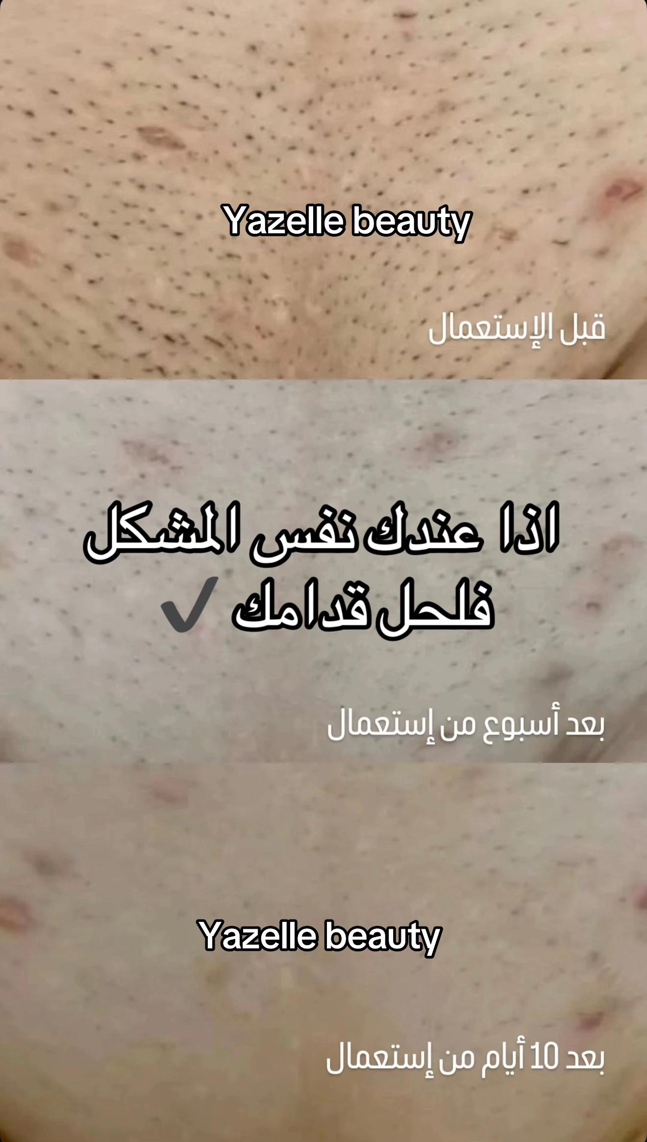 @جمالك وأنوثتك مع يزال🎀