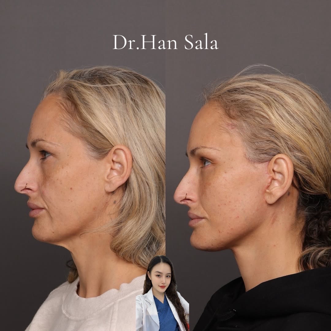@Dr.Han Sala Beauty