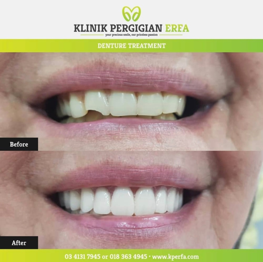 @Klinik Pergigian Erfa