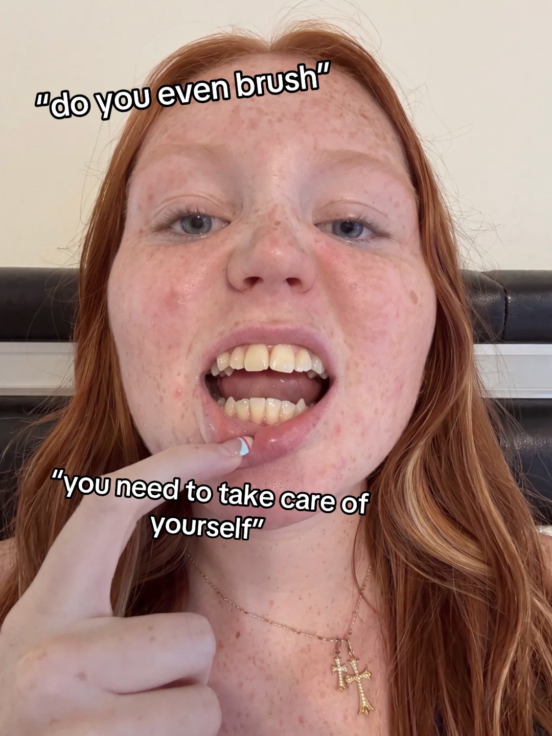 @A