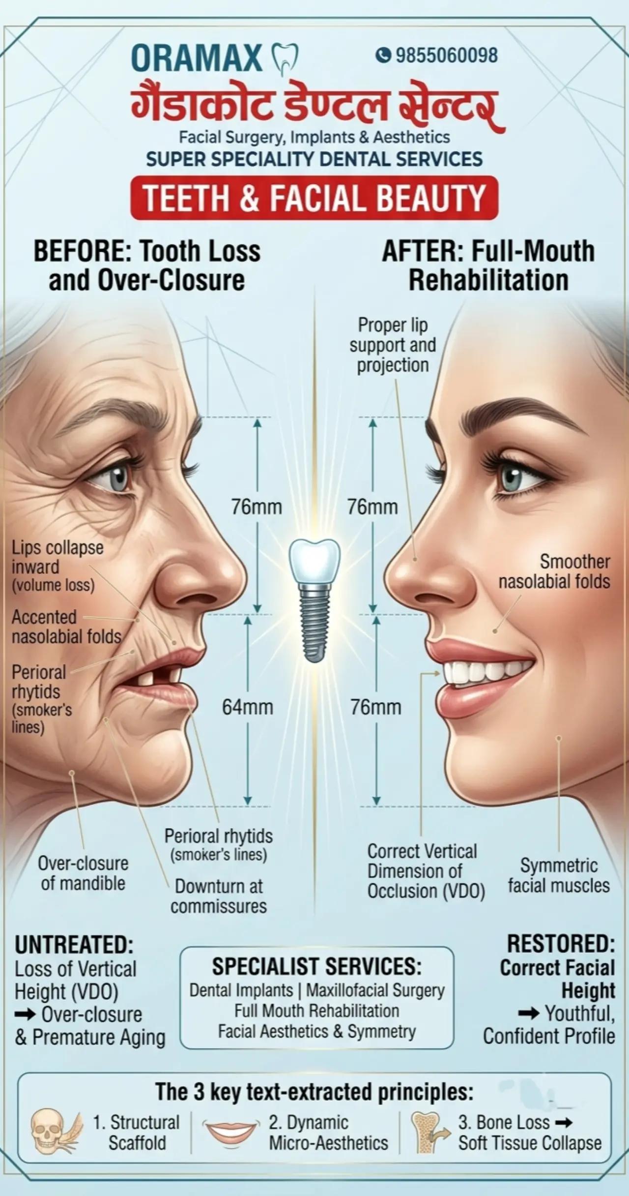@Dr. Krishna Regmi-MDS (OMFS)