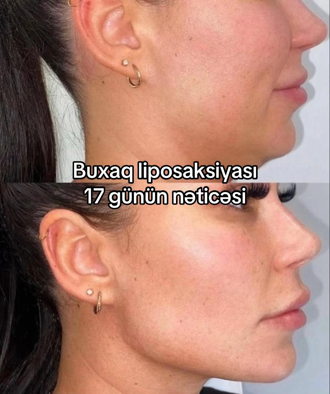 @Dr.ataxanli