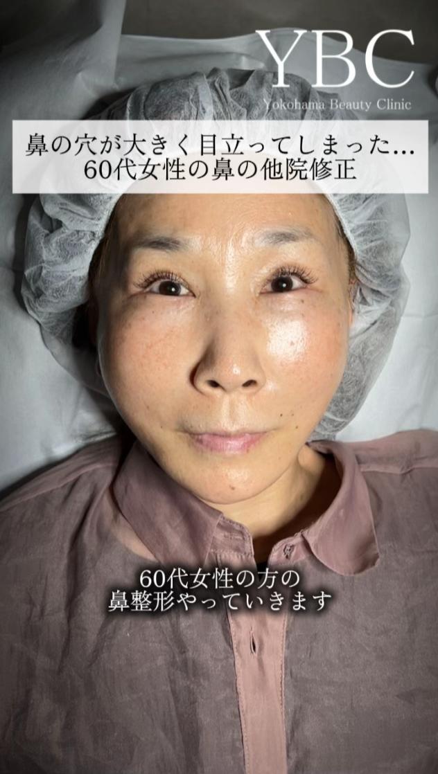@イソセン/美容外科医（磯村亮輔院長）