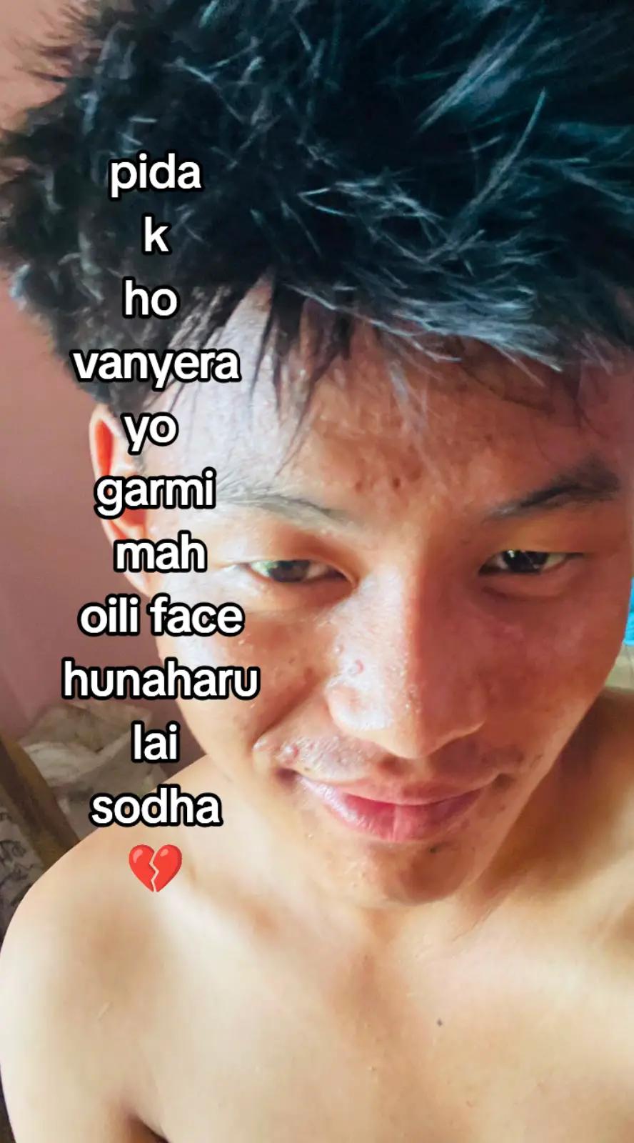 @आशिष याकपाङ्देन लिम्बु ❤️💐