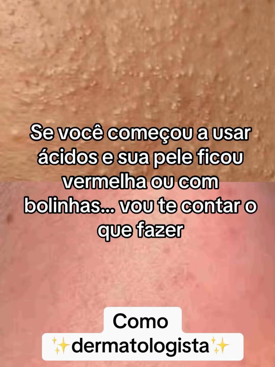 @Marina Morais