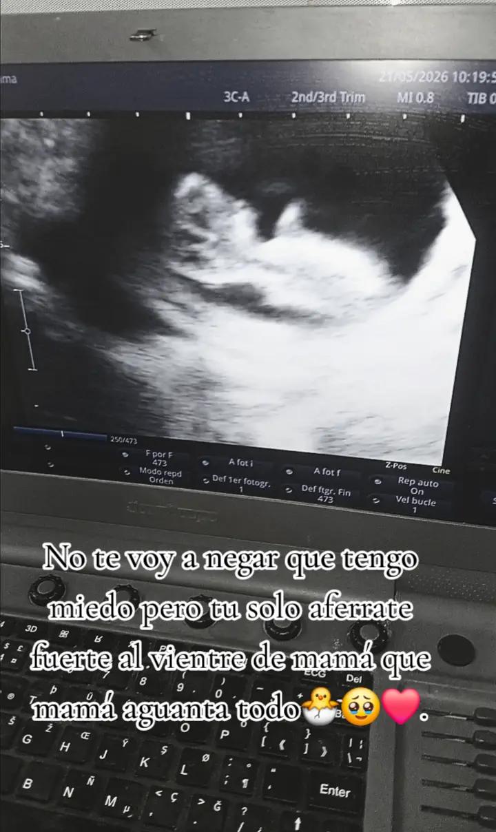 @Wendy Roma&ntilde;a