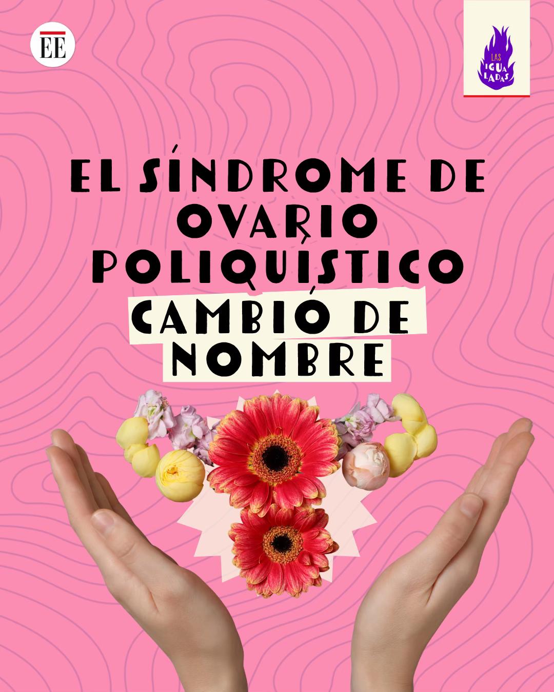 @Las Igualadas