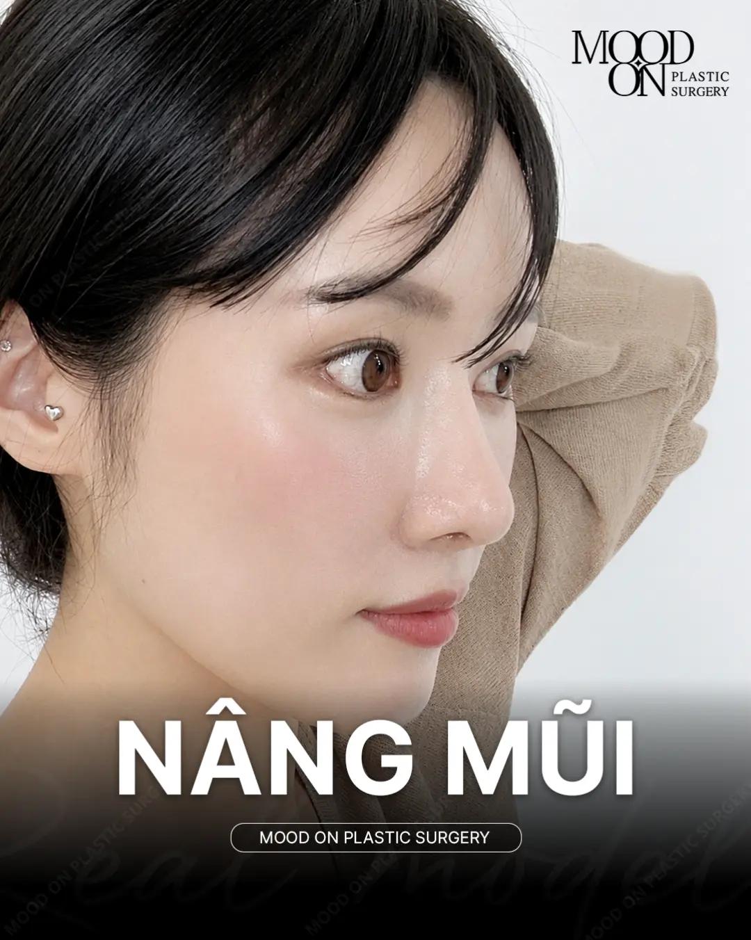 @Bệnh viện thẩm mỹ Mood On