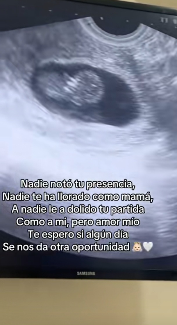 @Ebert Ledesma Narcisista