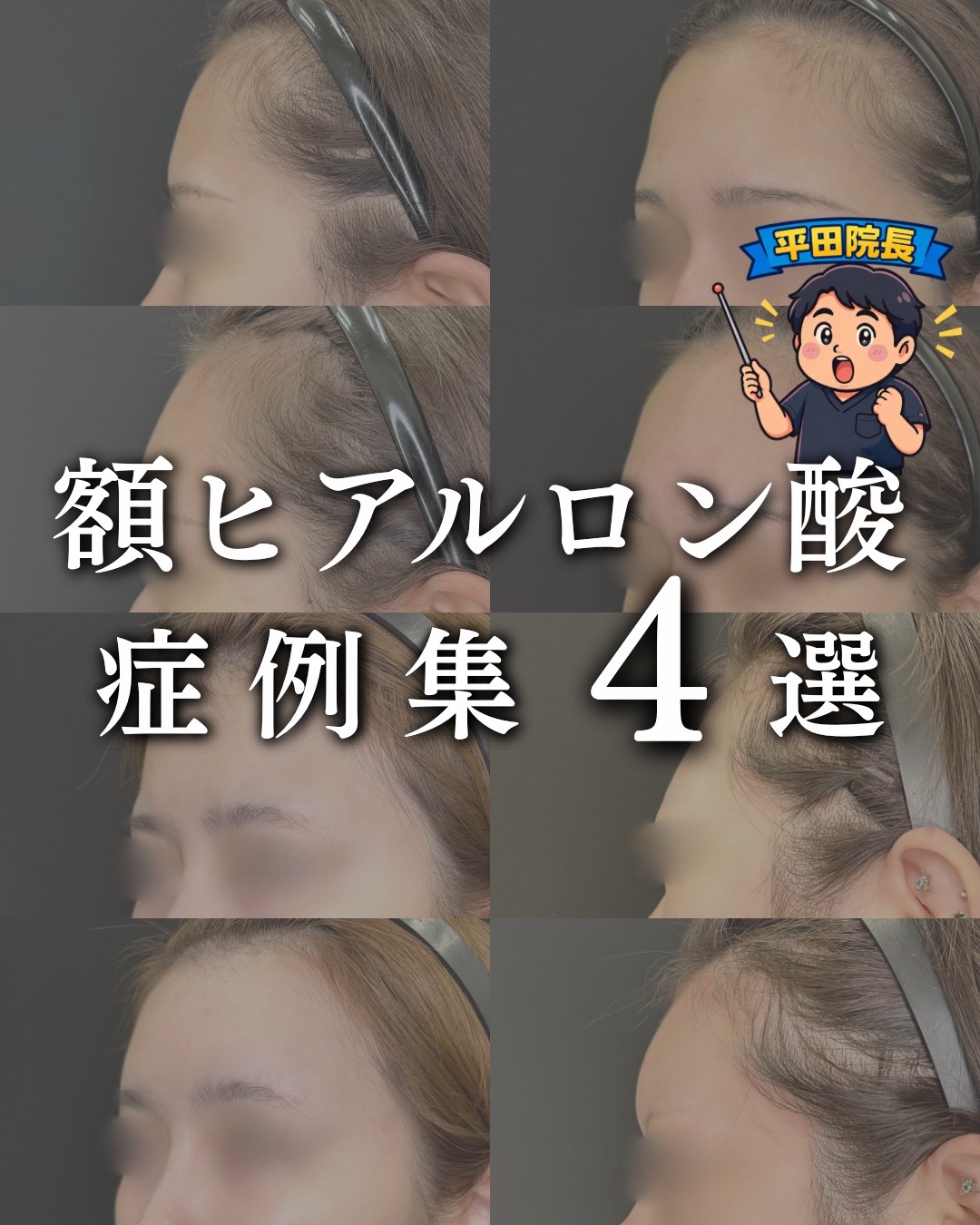 @ルラ美容クリニック大阪本院