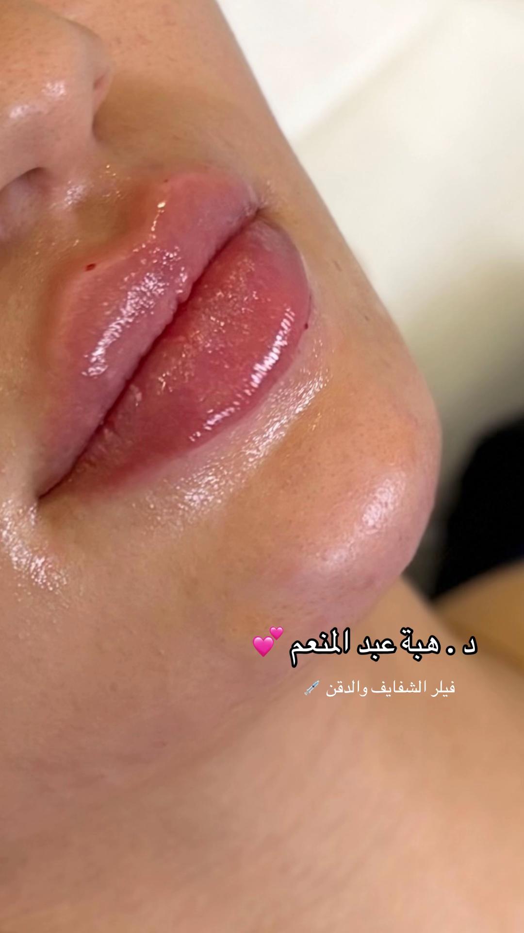 @مزدانه (فرع الملك عبدالله)