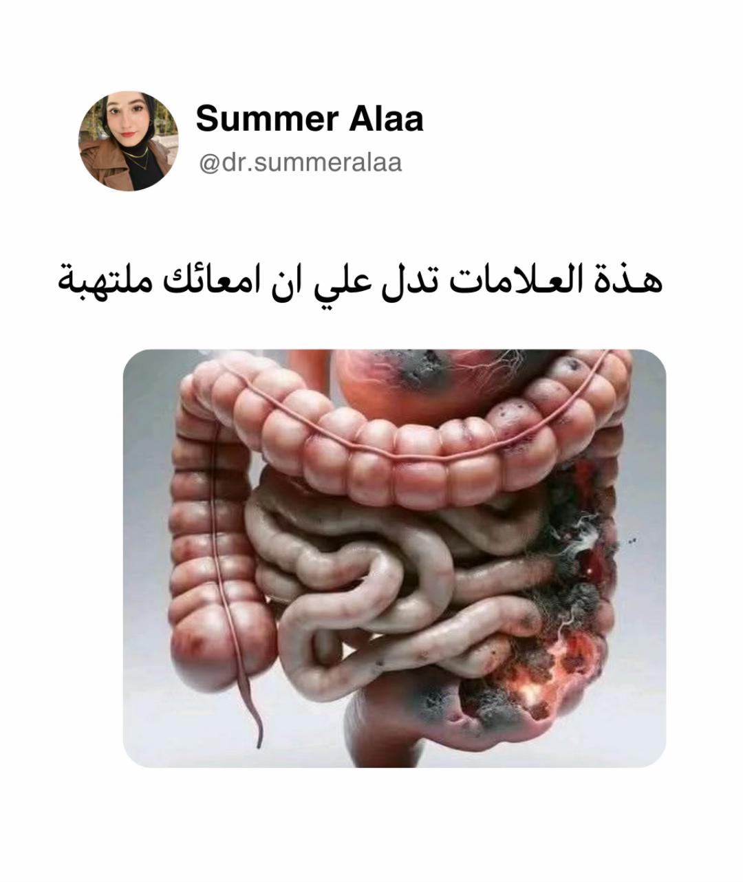 @Dr Summer Alaa | Msc,