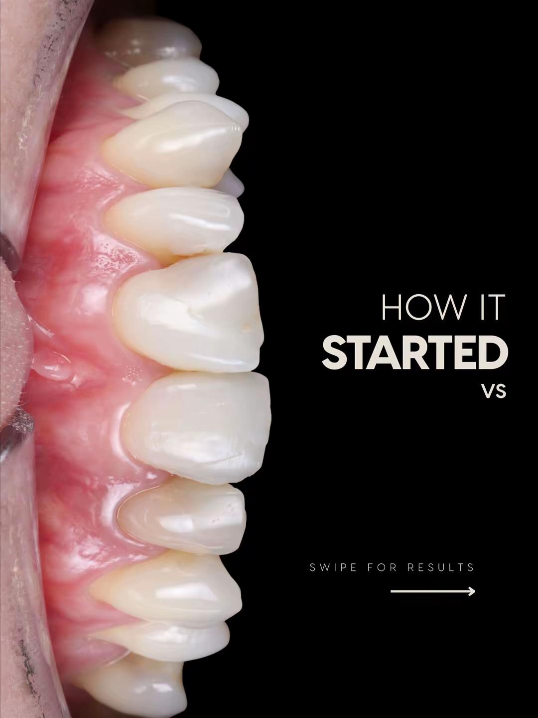 @Dentalexcellenceuk