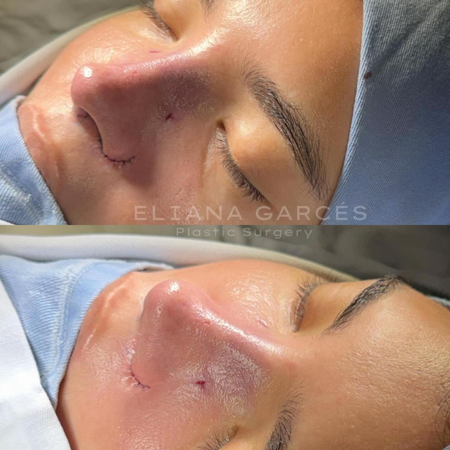 @Eliana Garc&eacute;s Plastic Surgery