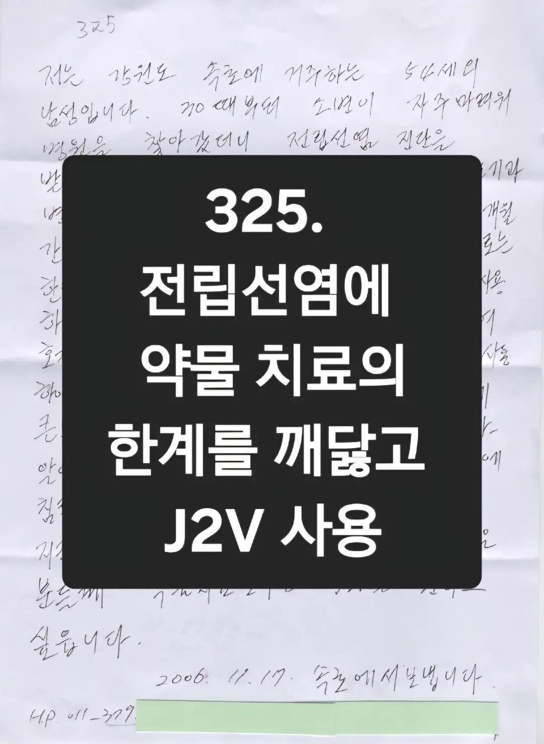 @전립선치료기 J2V