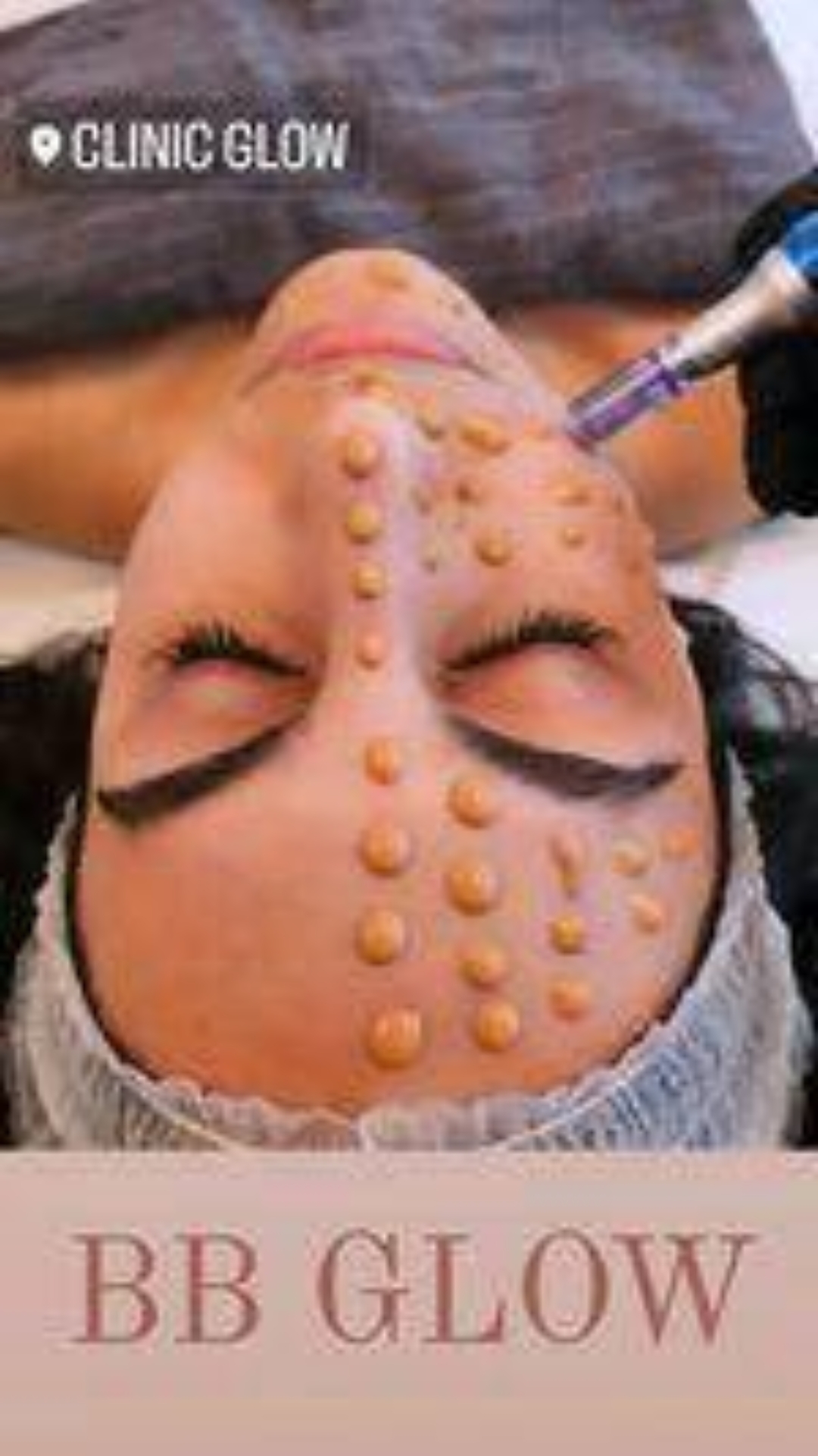 @Clinicglowdk