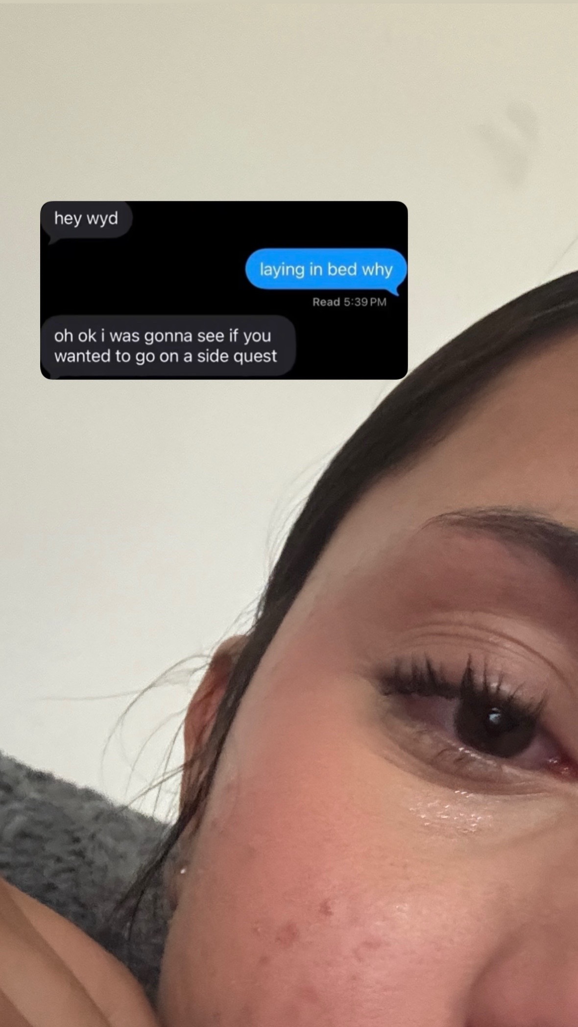@&reg;