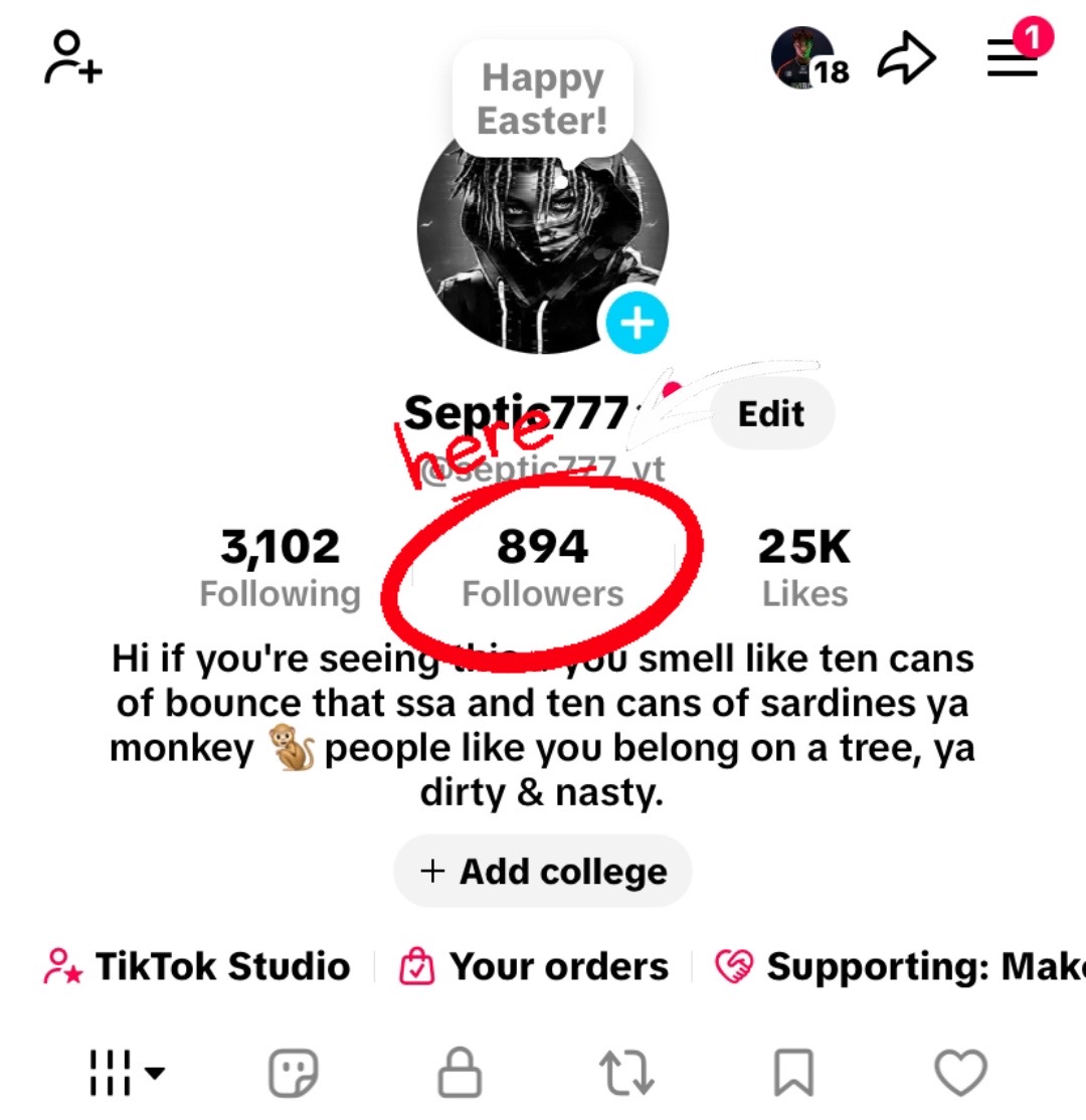 @Septic777
