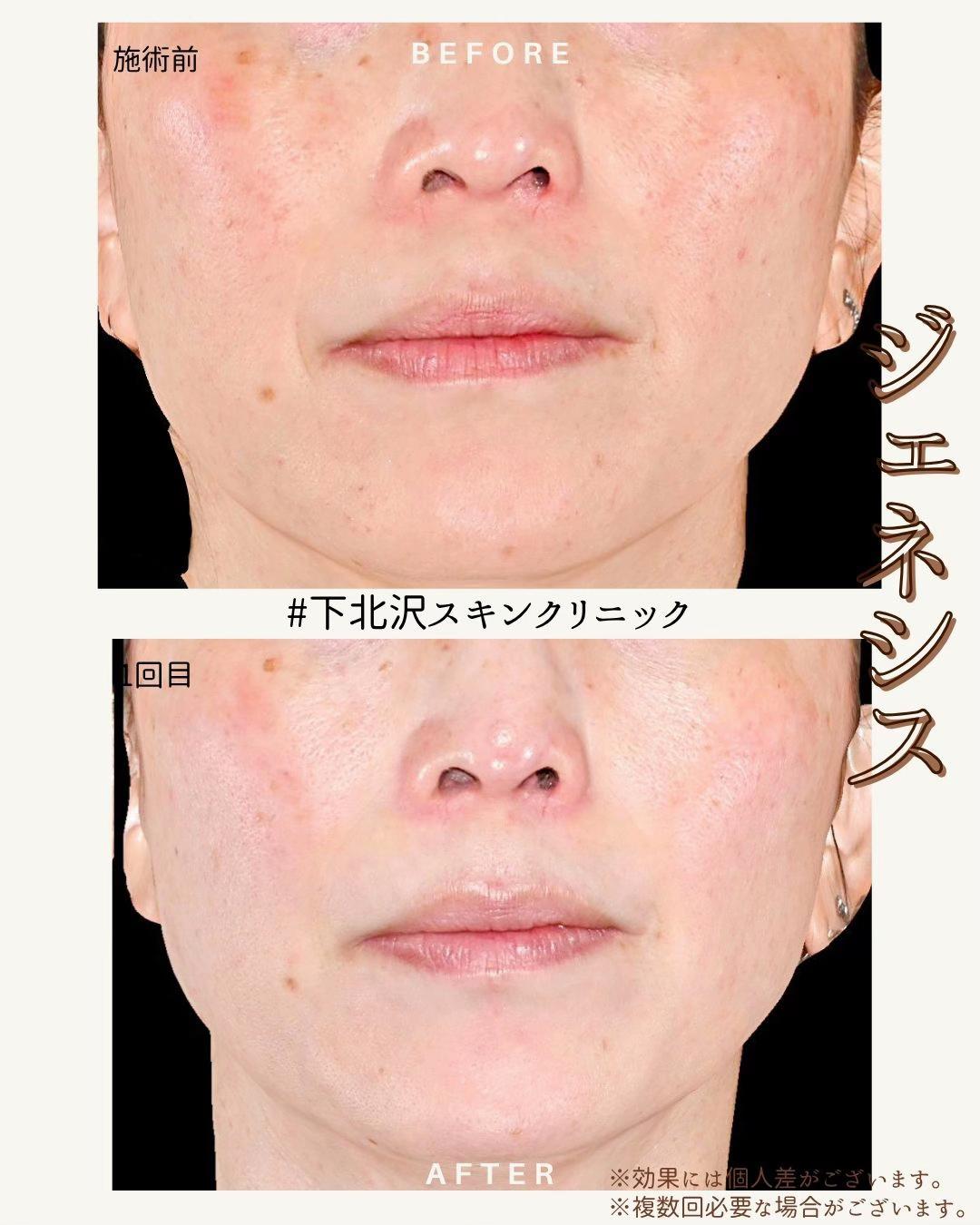 @下北沢スキンクリニック院長・こころの美容外科医・保坂宗孝