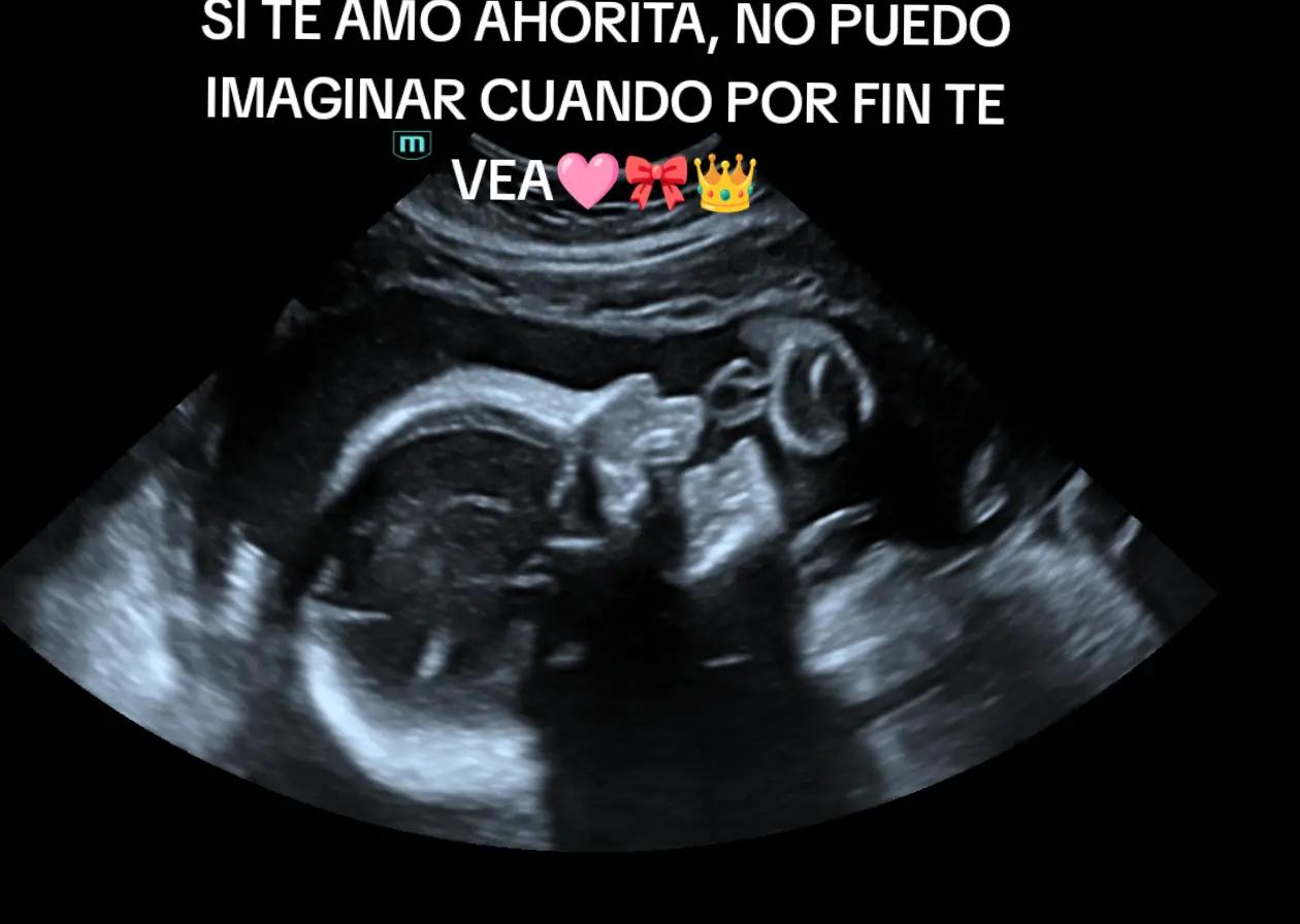 @Mari