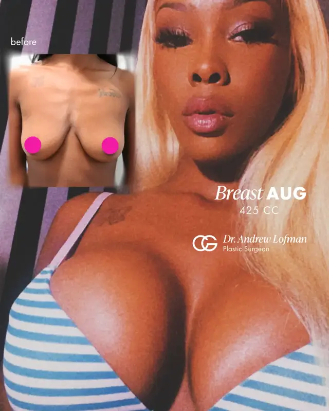 @CG Cosmetic Surgery | Miami