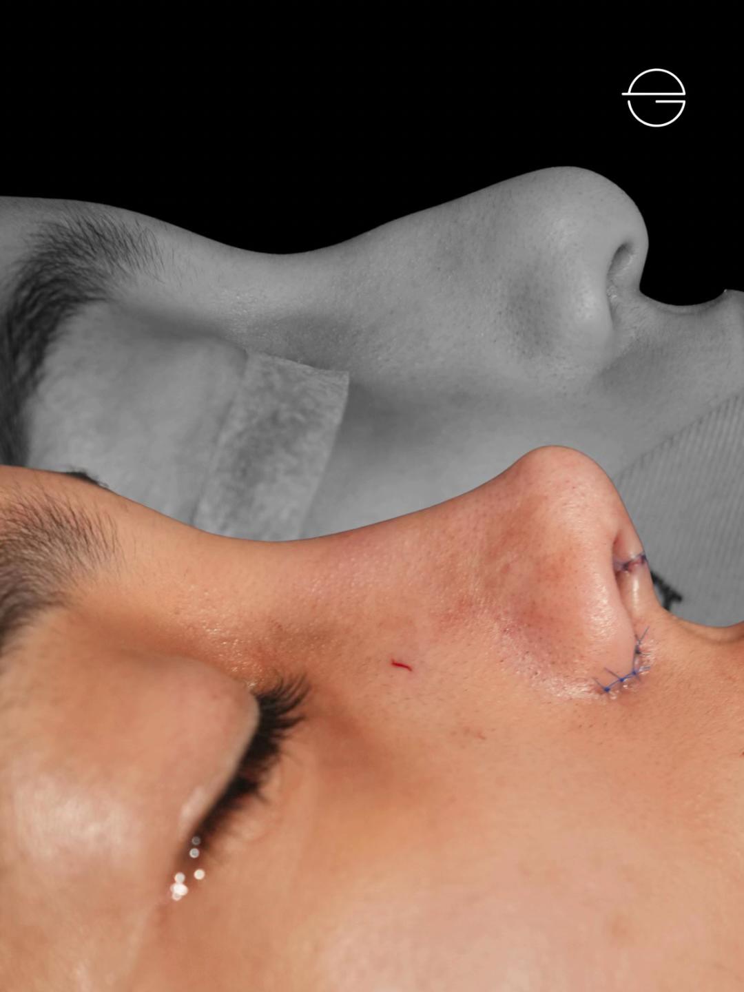 @Eliana Garcés Plastic Surgery