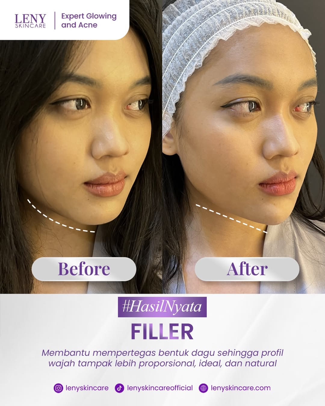 @Leny Skincare Karawaci