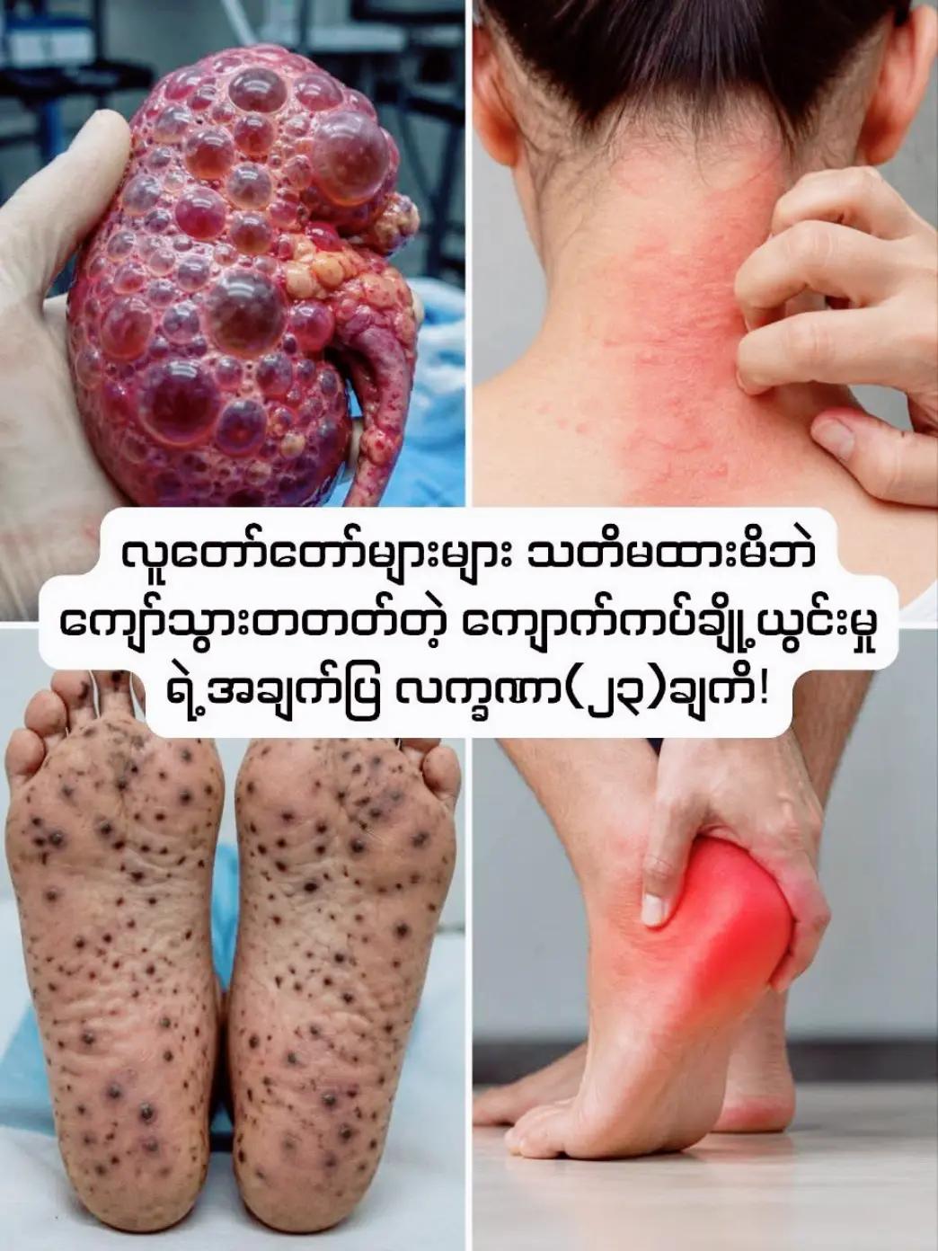 @ခင်