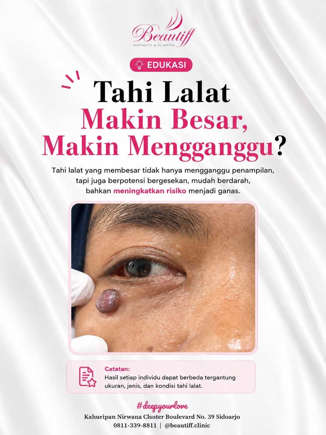 @Beautiff Clinic