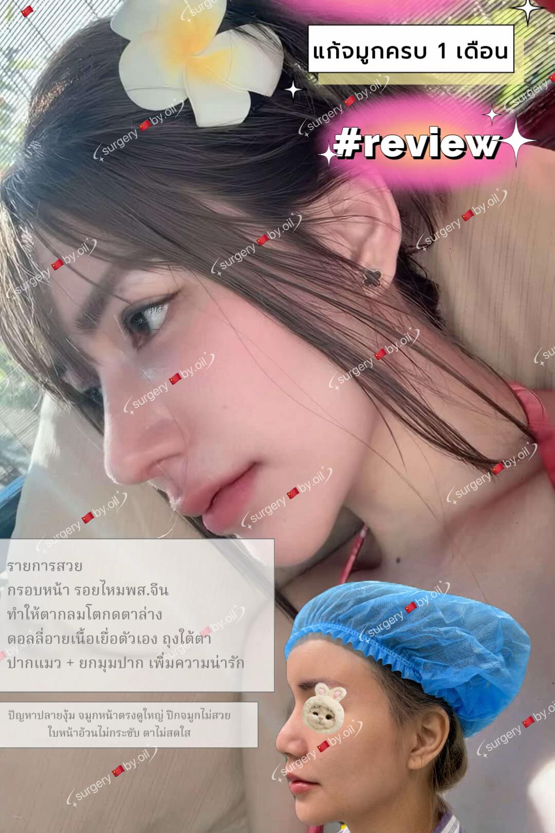 @😋ออ ชอบศัลย์จีน🇨🇳