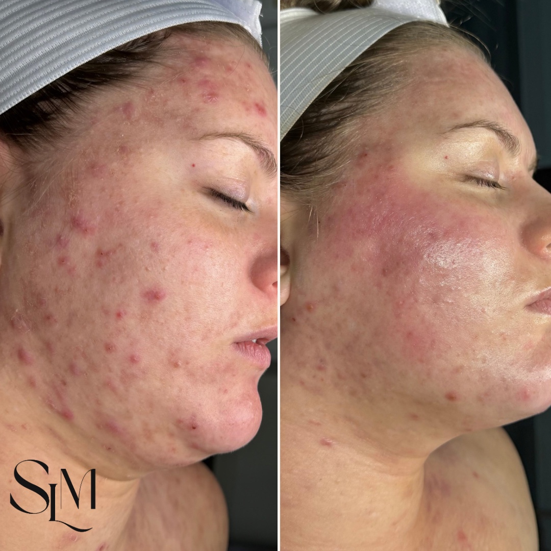 @Myrah | Midland Aesthetician