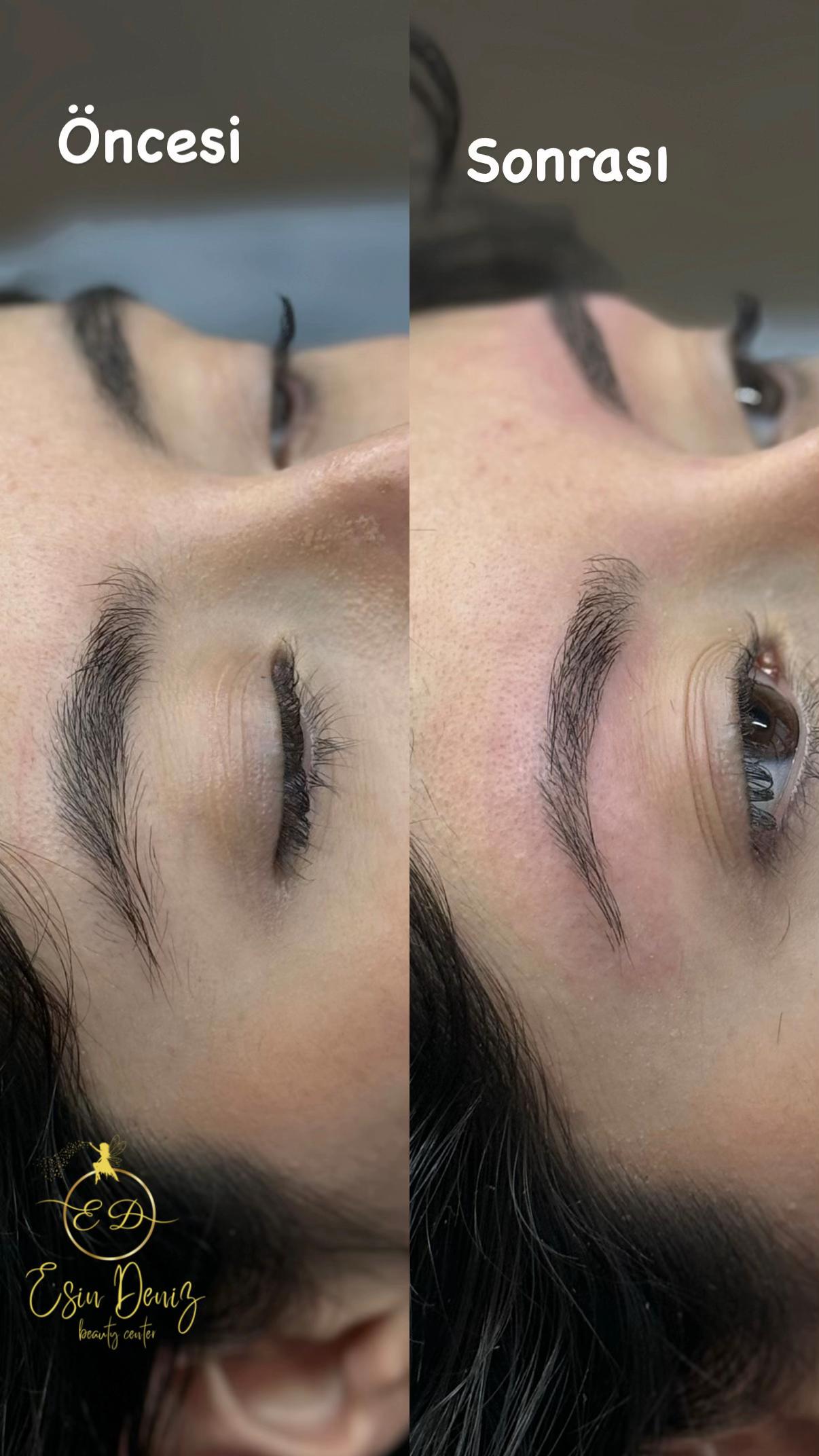@Esin Deniz Beauty center