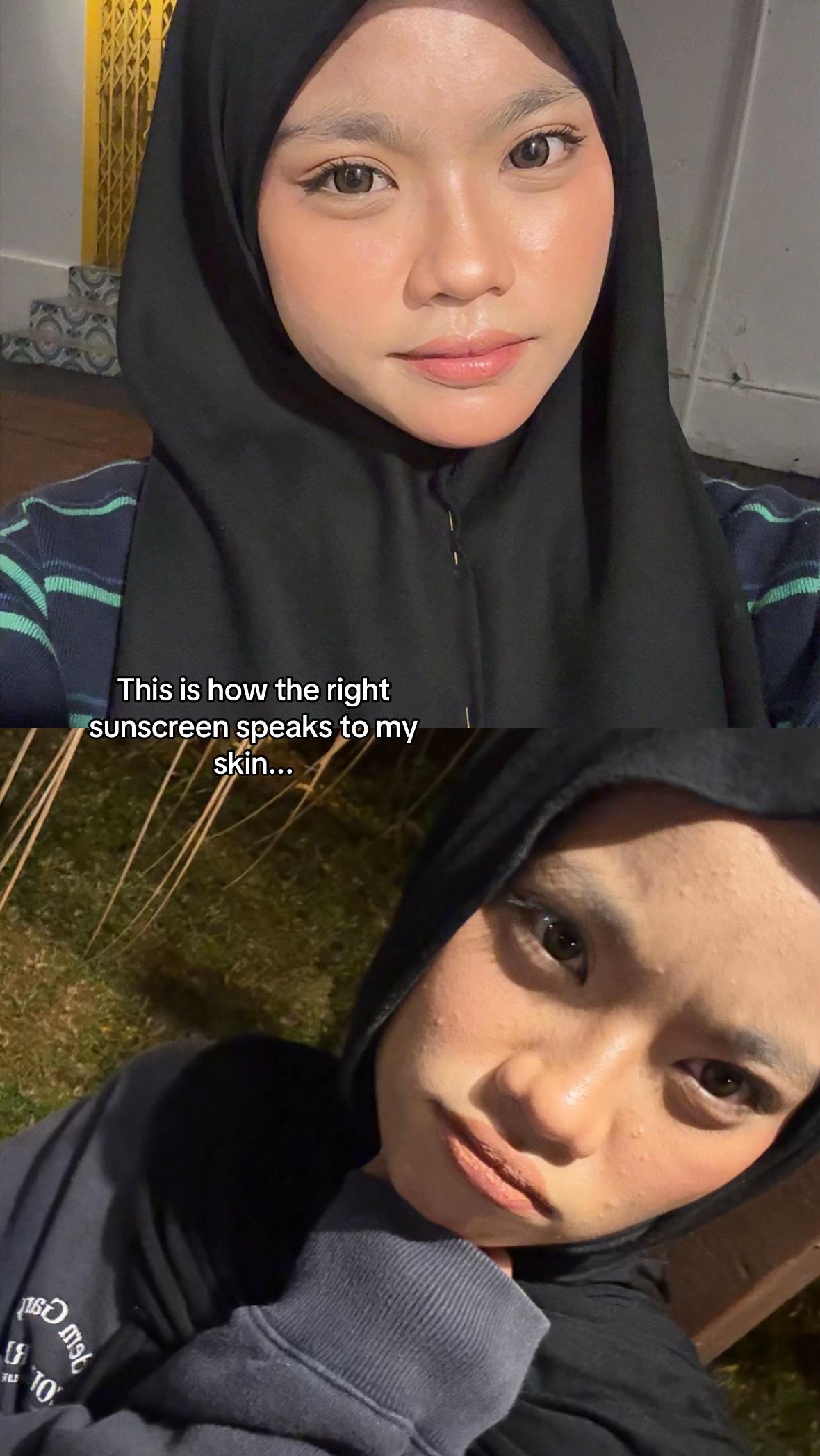 @ㅤ