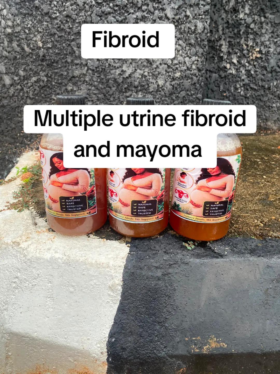 @omega fibroid removal herbs