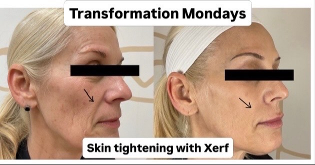 @Dr Paul, Dermatologist