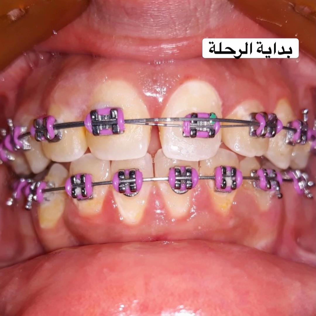 @Dr Tayssir Seddik