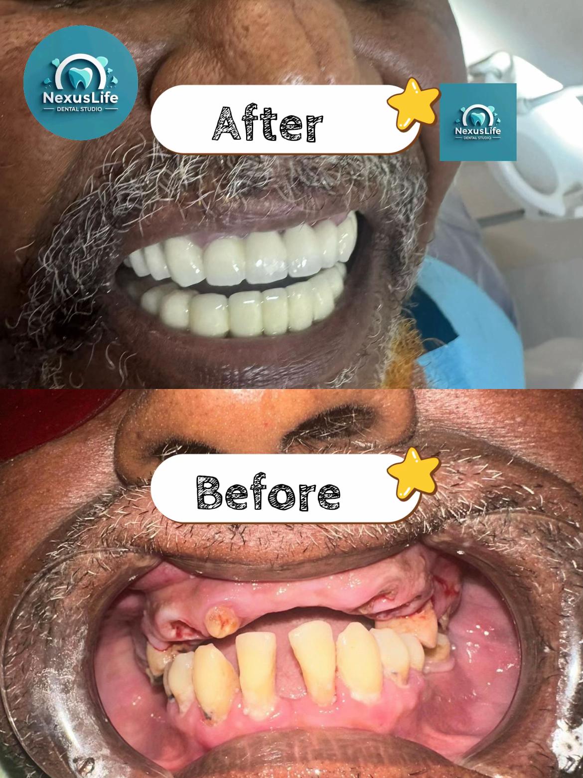 @NEXUSLIFE DENTAL CLINIC🦷