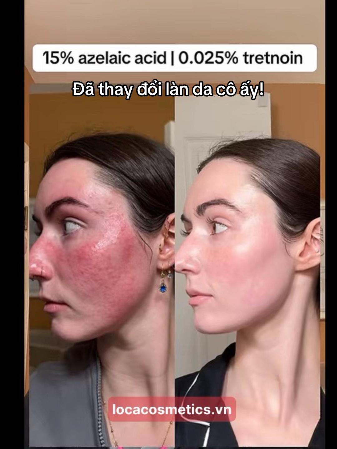 @Loca Cosmetics