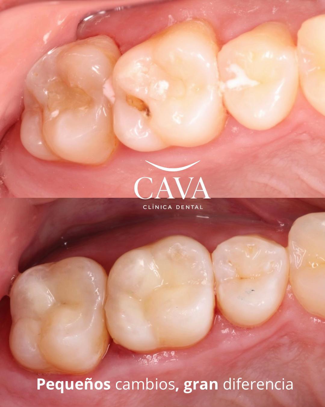 @Cava Clínica Dental 🦷