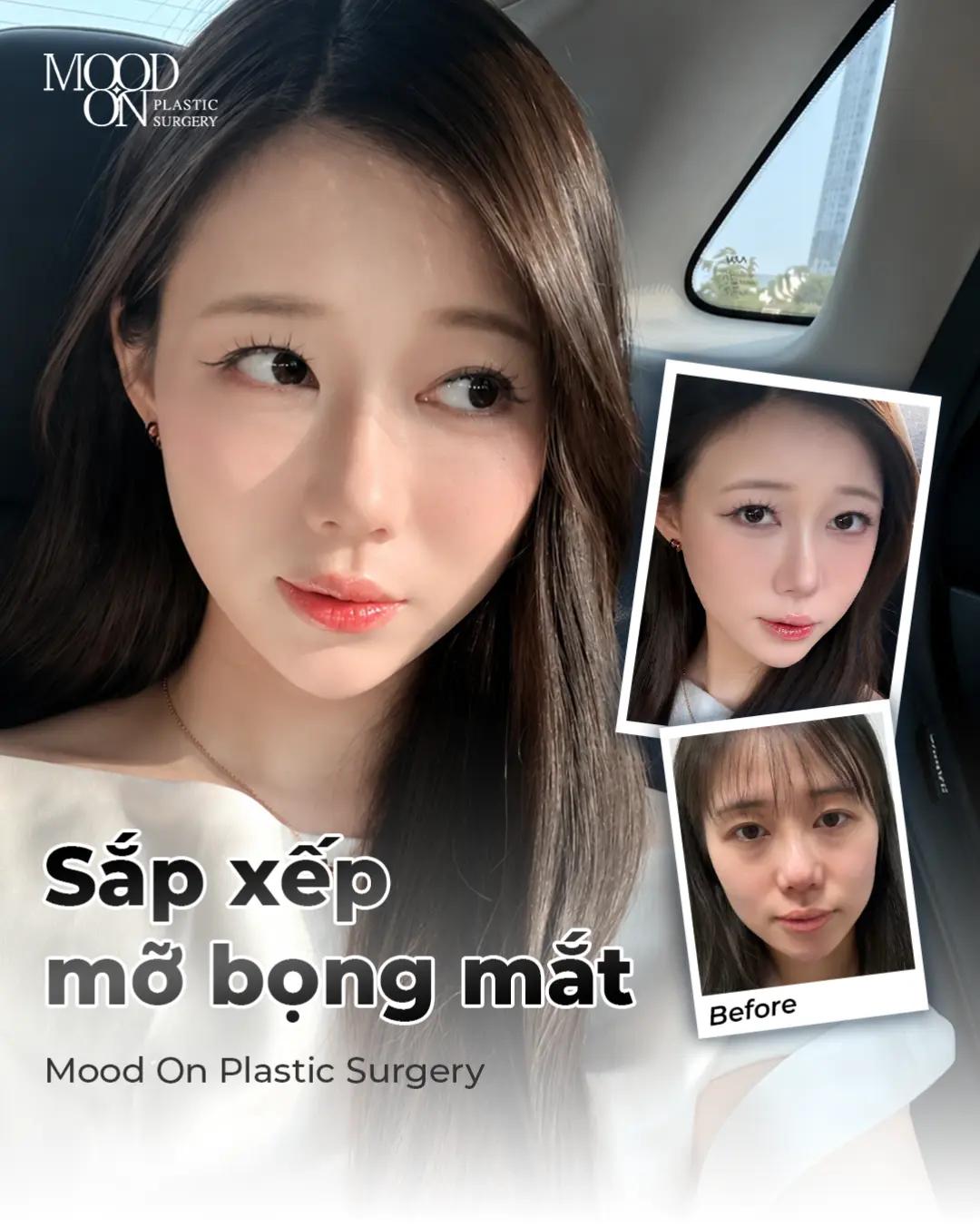 @Bệnh viện thẩm mỹ Mood On