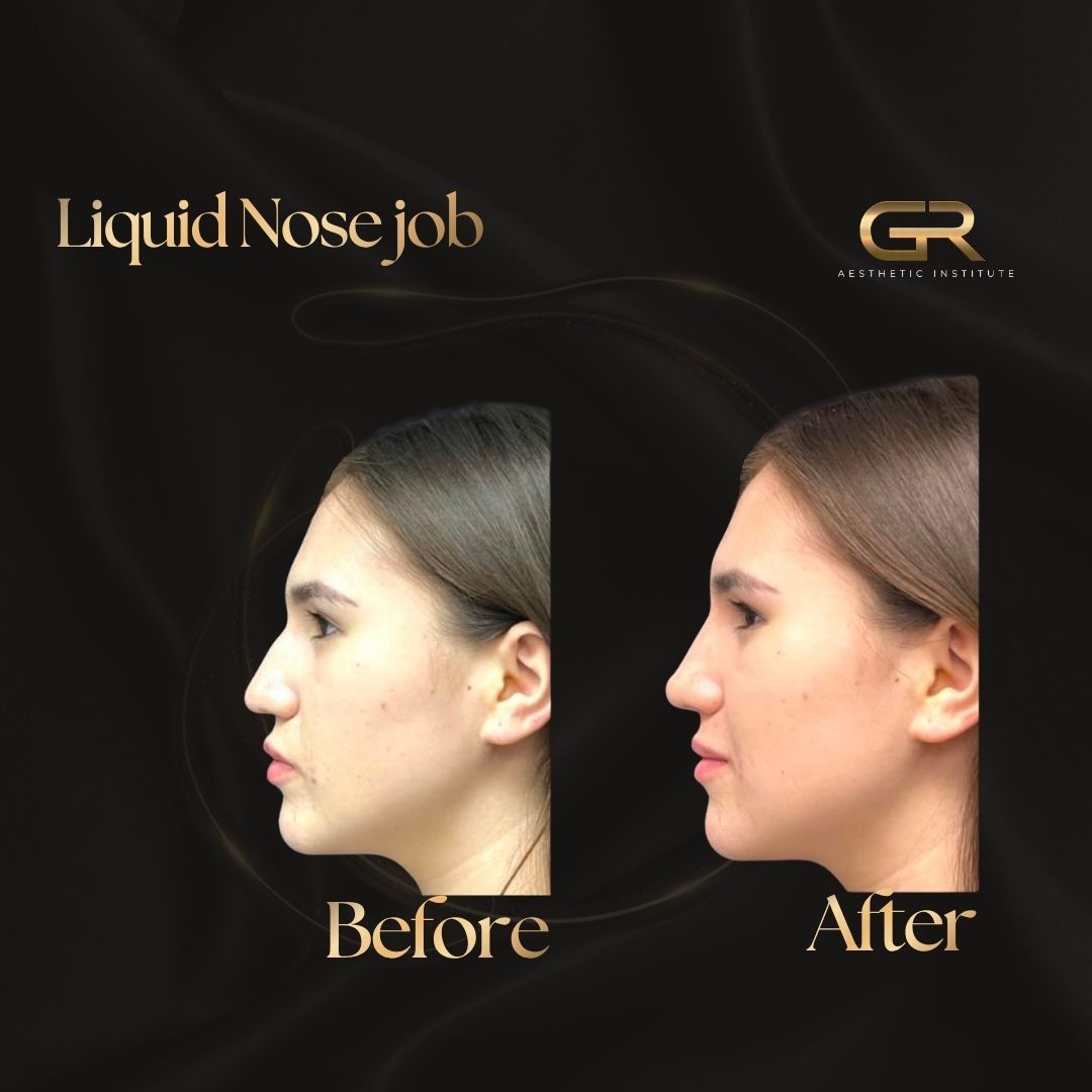 @Get Refreshed