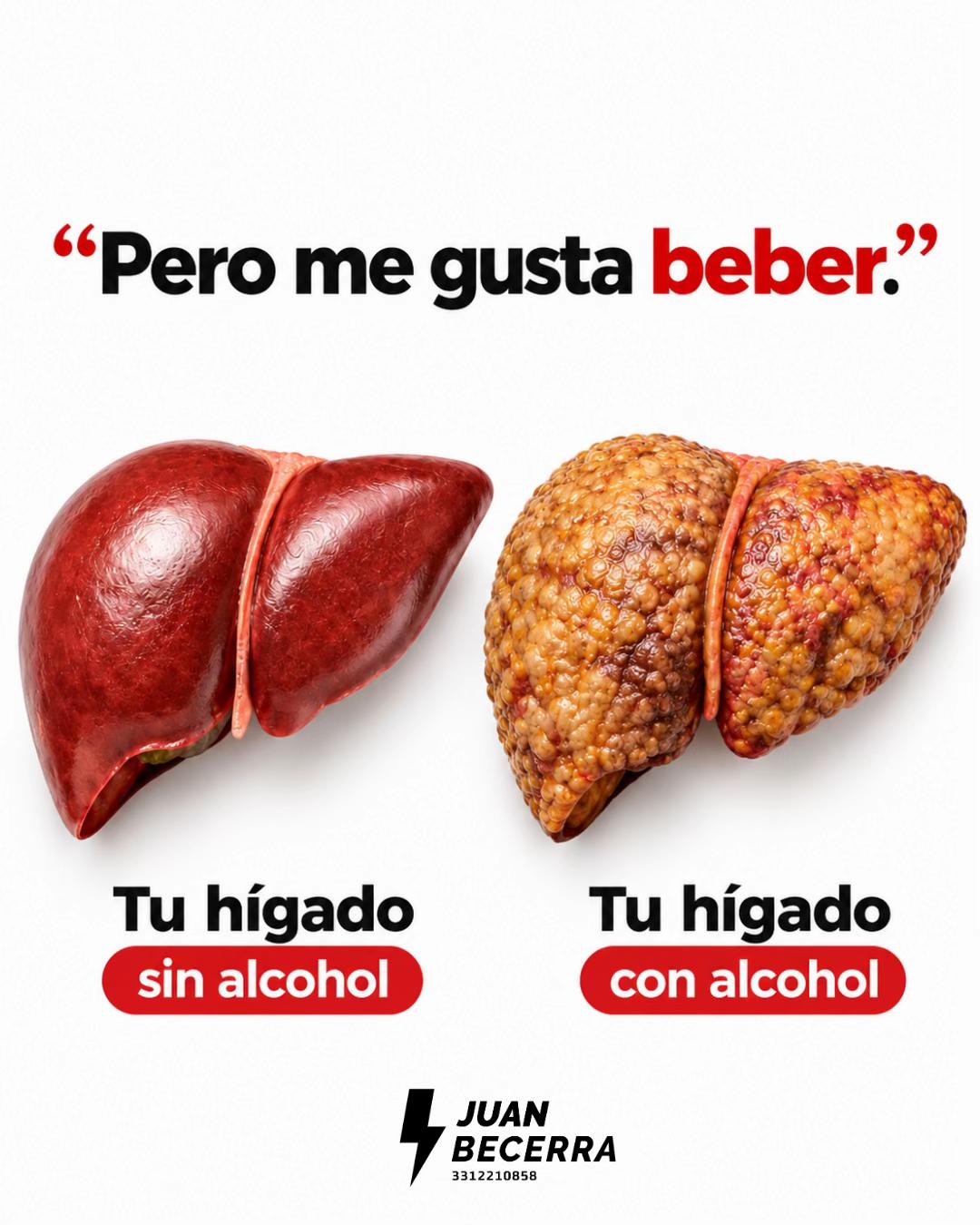 @MPN Suplementacion