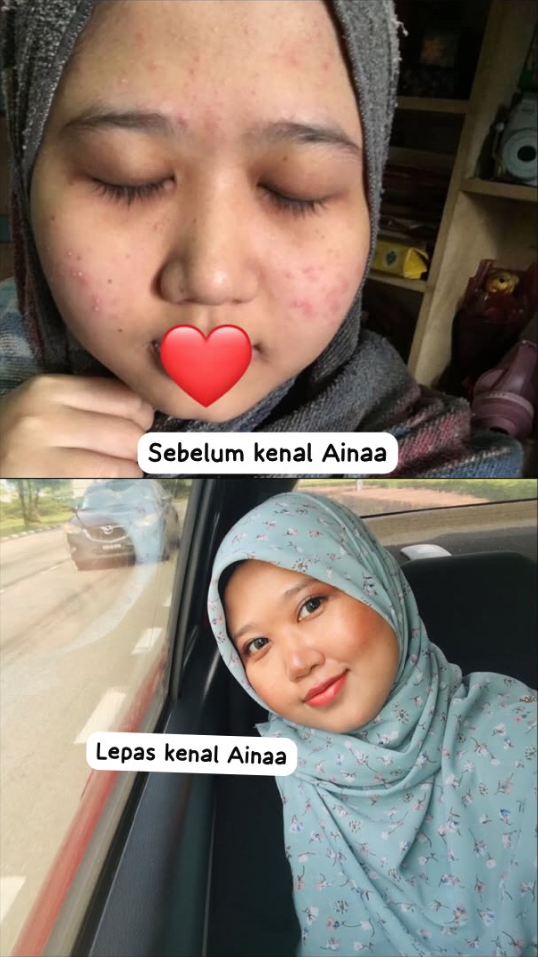 @AINAANIDA