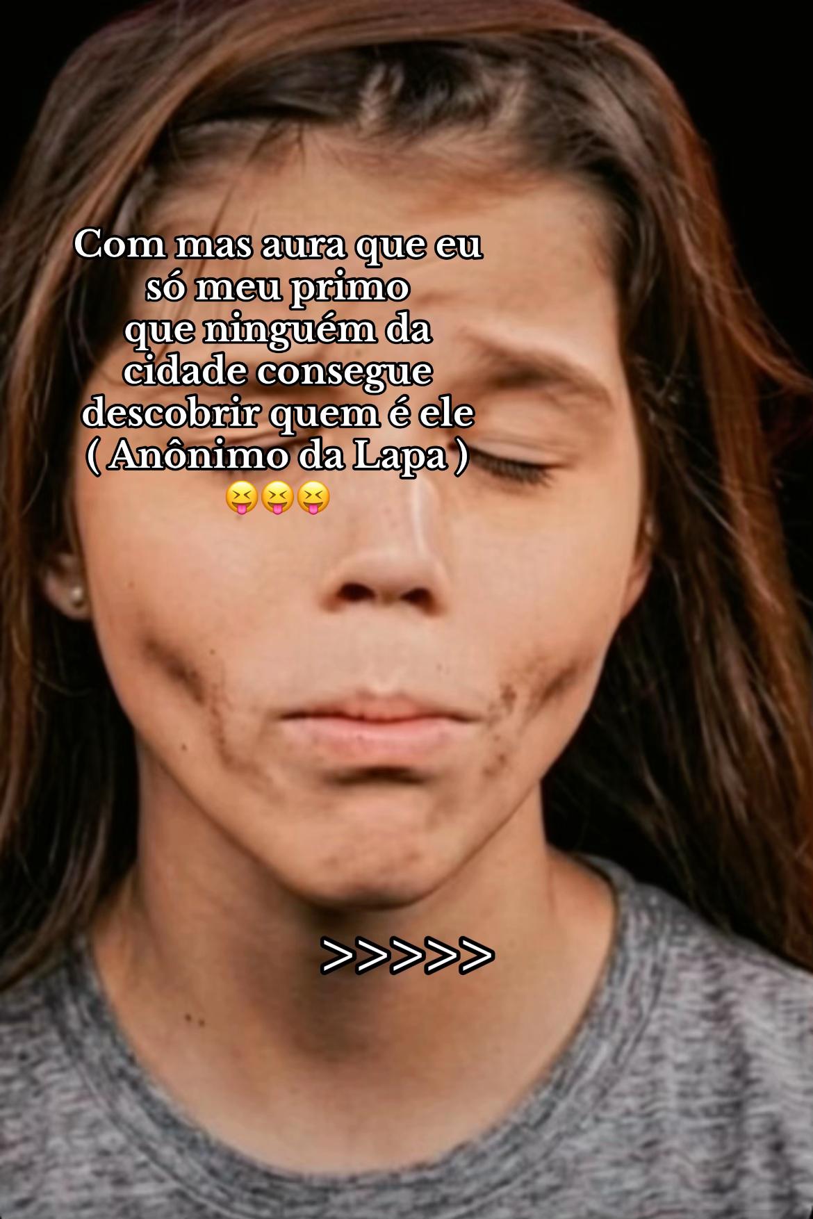 @Alanis Catellan