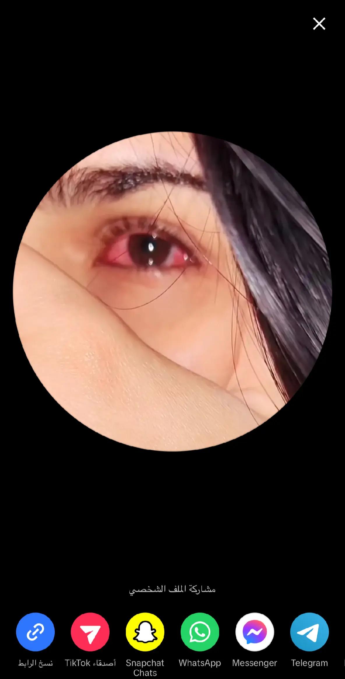 @🤍﮼بەرخە ﮼سپیەکەم