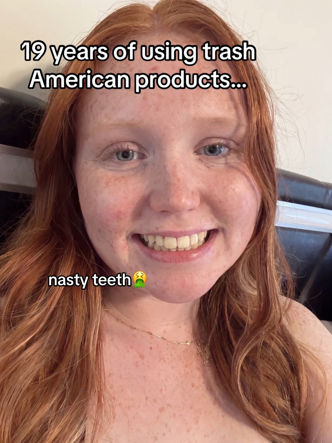 @A
