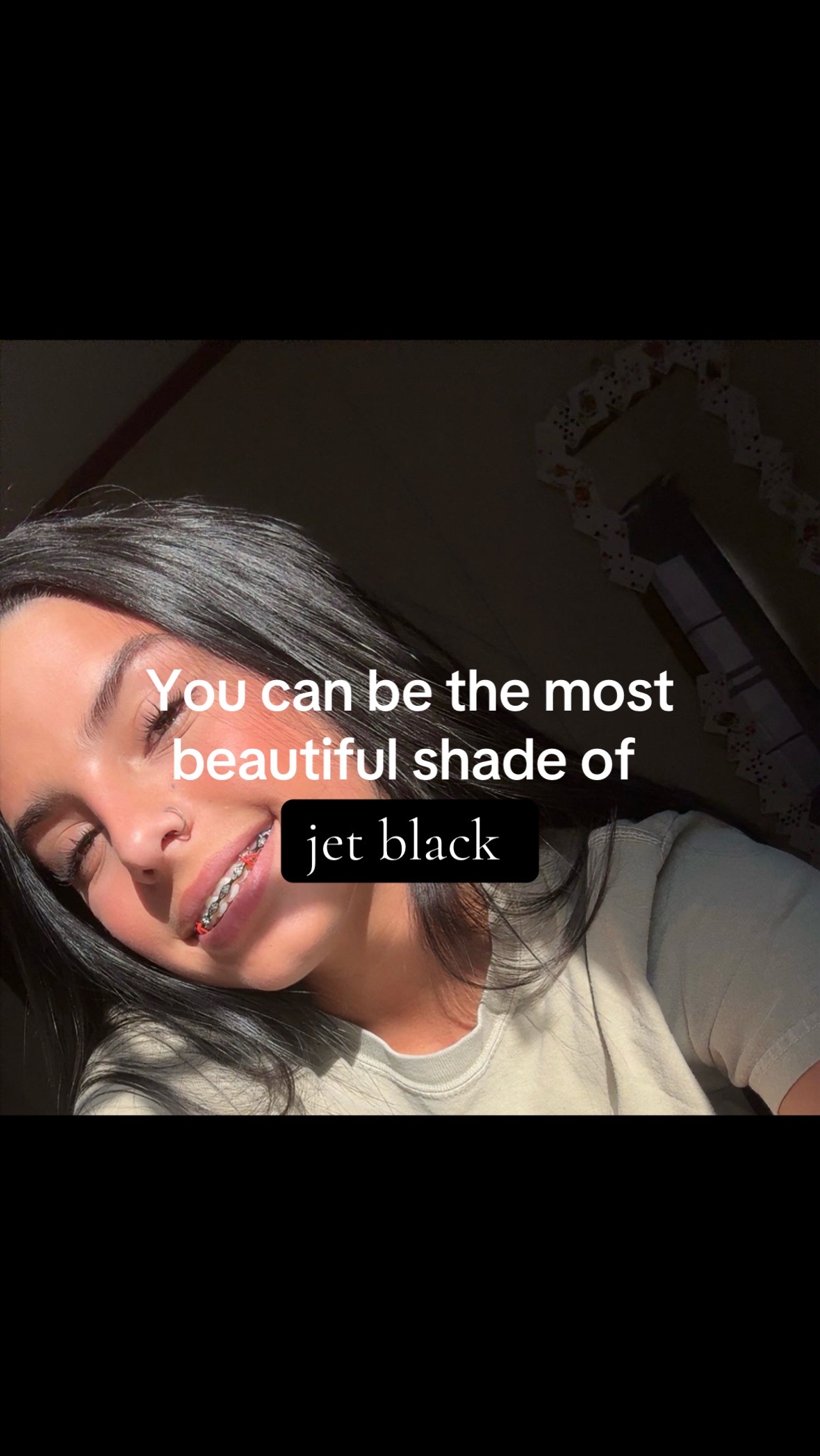 @KG💸