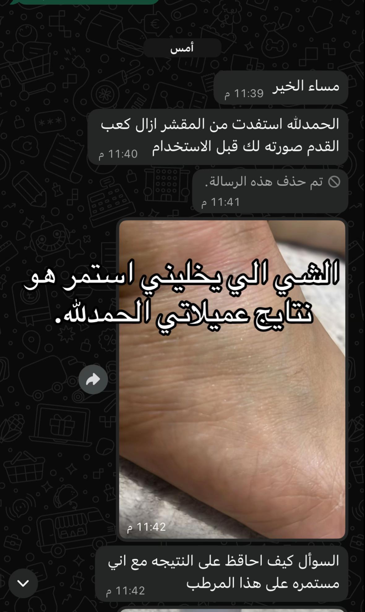 @هاي لينا| متجر قمر سابقاً