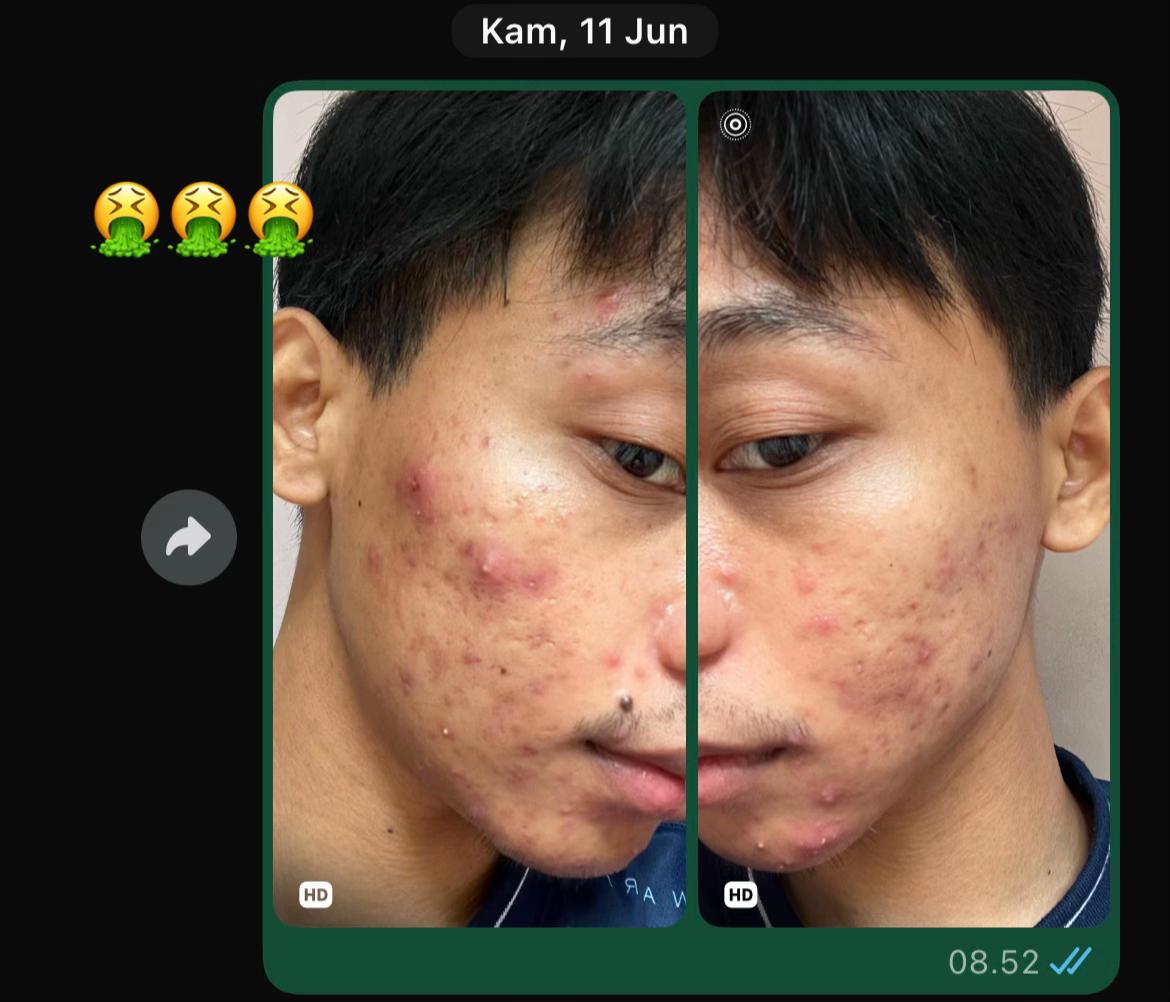 @๐๐ฃ—๐จ๐ฃ